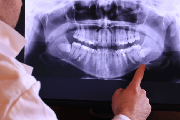 Best Emergency Treatment for Dental Infections or Abscesses in Jackson, MS