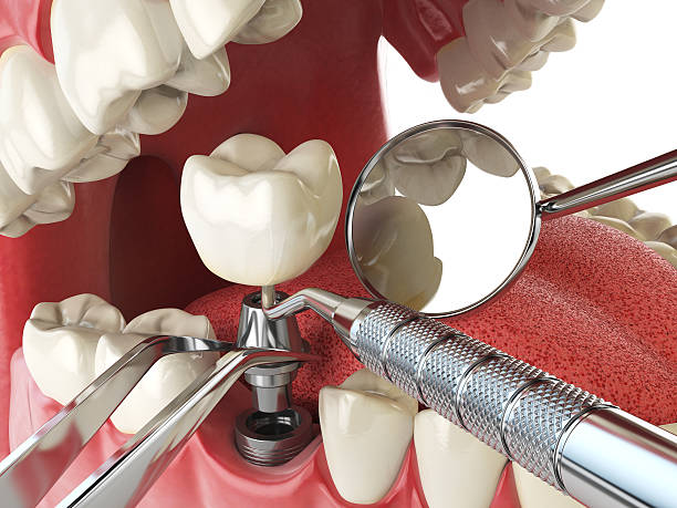 Best Cosmetic Emergency Dentistry in Jackson, MS